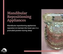 Image result for Mandibular Repositioning Appliance