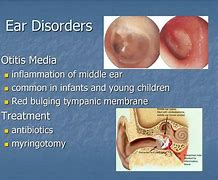 Image result for Ear Disorders
