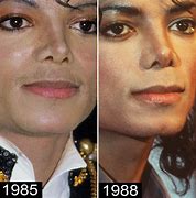 Image result for Michael Jackson Nose Before Surgery