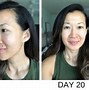Image result for Zo Skin Care Results