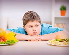 Image result for Common Questions Obese Children As
