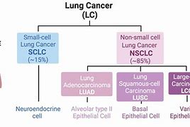 Image result for Squamous Non-Small Cell Lung Cancer