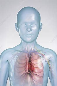 Image result for Thoracic Drainage