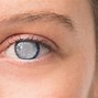 Image result for Signs of Eye Problems