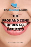 Image result for Dental Implants Pros and Cons