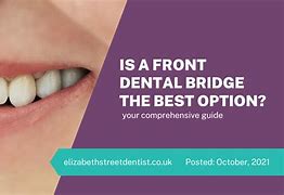 Image result for Dental Bridge Floss Threader