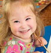 Image result for Angelman Syndrome Baby