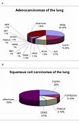 Image result for Non Small Cell Lung Cancer Figure