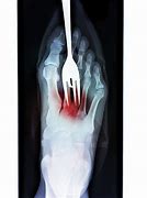 Image result for Stabbed with Fork