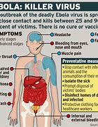 Image result for Ebola Symptoms