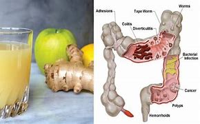 Image result for Liquid Colon Cleanse