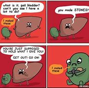 Image result for Passing Kidney Stone Jokes