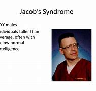 Image result for Celebrity with Jacobs Syndrome