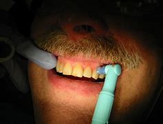 Image result for Narrow Dent Removal