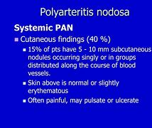 Image result for Polyarteritis Nodosa