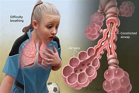 Image result for Asthma Symptome