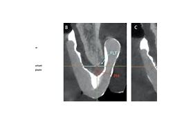 Image result for Cone Beam CT Scan
