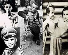 Image result for Josef Mengele Twins Sewn Together
