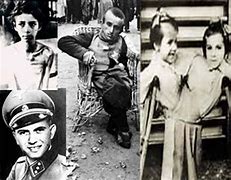 Image result for Josef Mengele Twins Sewn Together