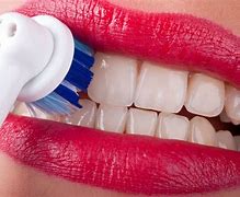 Image result for Teeth-Cleaning Smile