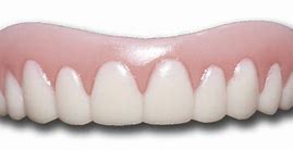 Image result for White Teeth Smile