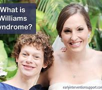 Image result for Williams Syndrome Facial Features