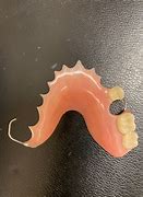 Image result for Flipper Dental Pic