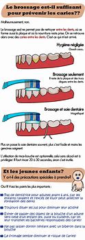 Image result for Gouttière Brossage De Dents