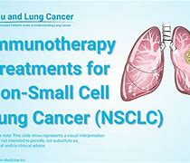 Image result for Non-Small Cell Lung Cancer Treatment