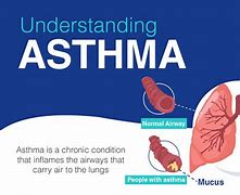 Image result for Person with Asthma