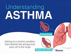 Image result for Asthma Description