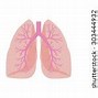 Image result for CT Picture of Lung Adenocarcinoma Cancer
