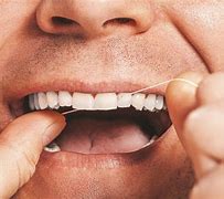 Image result for Rexall Teeth Cleaning Kits