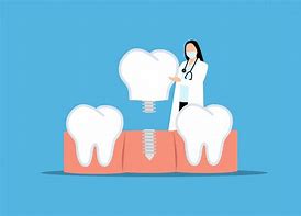 Image result for Dental Appliance