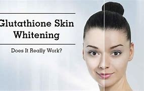 Image result for Glutathione for Skin Whitening
