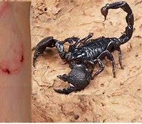 Image result for Scorpion Wound