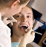 Image result for tooth cleaning