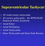 Image result for Sinus Tachycardia vs Supraventricular Tachy