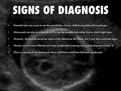 Image result for Edwards Syndrome Ultrasound