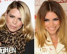 Image result for Billie Piper Surgery