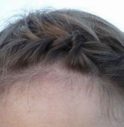 Image result for Pixie Hairstyles Over 70