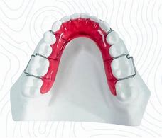 Image result for Dental Appliance