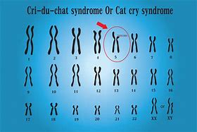 Image result for CRI Du Chat Chromosome