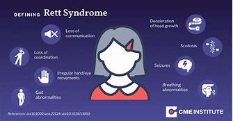 Image result for Rett's Disorder