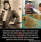 Image result for Henrietta Lacks Tumor