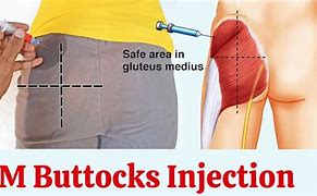 Image result for Intramuscular Injection Buttocks