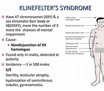 Image result for Klinefelter Syndrome Diagram