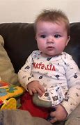 Image result for Klinefelter Syndrome Baby