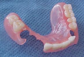 Image result for Resin Base Partial Denture