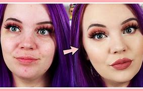 Image result for Girl with Blemish